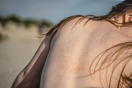 Histoires de peau : vivre avec des maladies cutanées